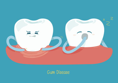 Tips For Gum Recession Prevention