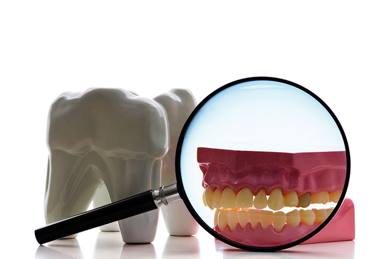 Advanced Root Canal Technology in Georgetown