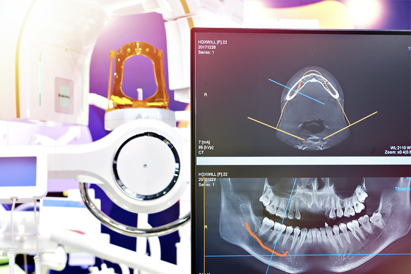 Digital X-Rays in Georgetown