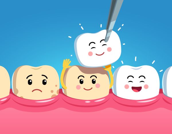 What Are Dental Appliances?