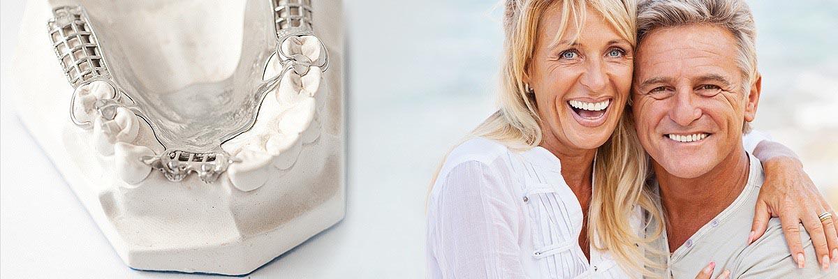 Georgetown Dental Crowns