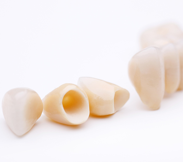 Georgetown Dental Crowns and Dental Bridges