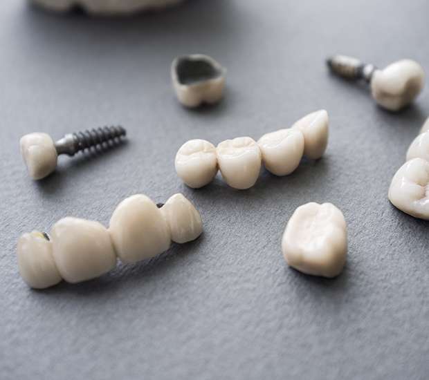 Georgetown The Difference Between Dental Implants and Mini Dental Implants
