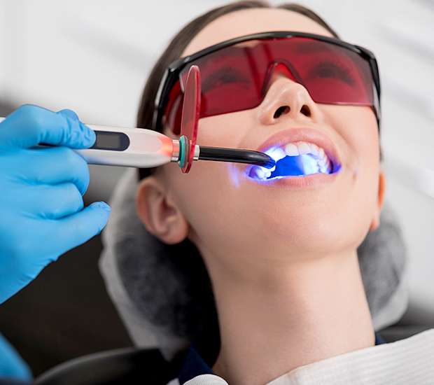 Georgetown Professional Teeth Whitening