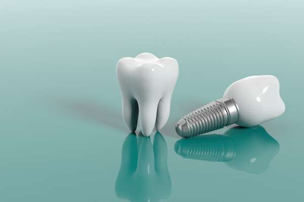 Multiple Teeth Replacement Options: One Implant for Two Teeth from Healthy Smiles Dentistry Georgetown in Georgetown, TX