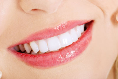 How Much Does It Cost To Get Your Teeth Whitened In South Africa